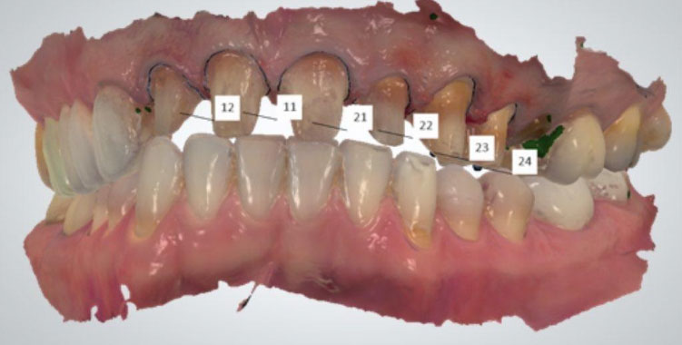 Best Advanced Dental Treatment in Nigdi Pradhikaran