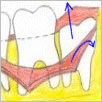 Incise soft tissue